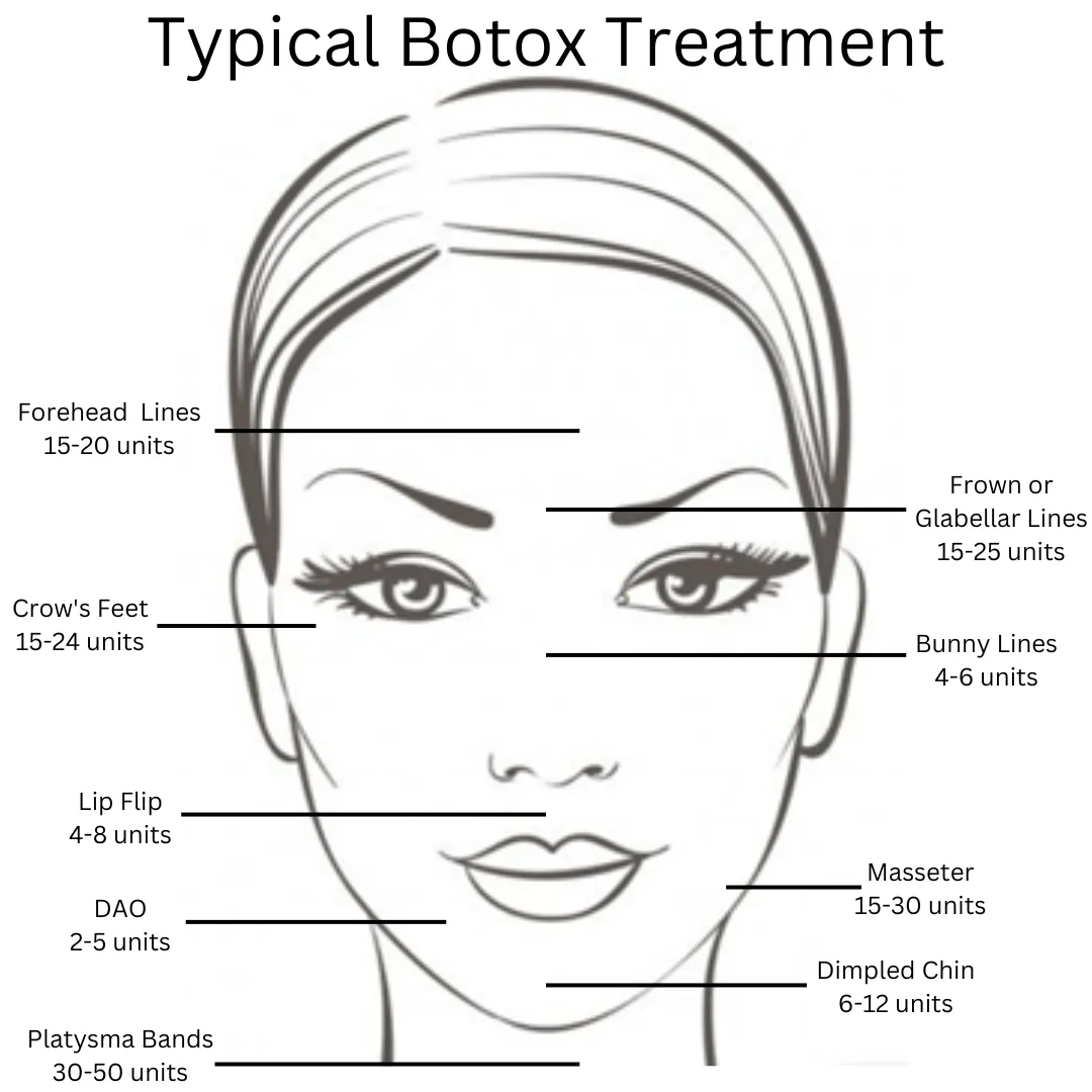 Typical Botox Treatment Areas | AgeLess Medical Aesthetics in Cheyenne, WY