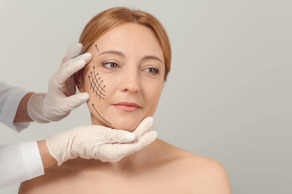 A Woman getting treatment and arrow marks on her face | Radiesse Services | AgeLess Medical Aesthetics in Cheyenne, WY