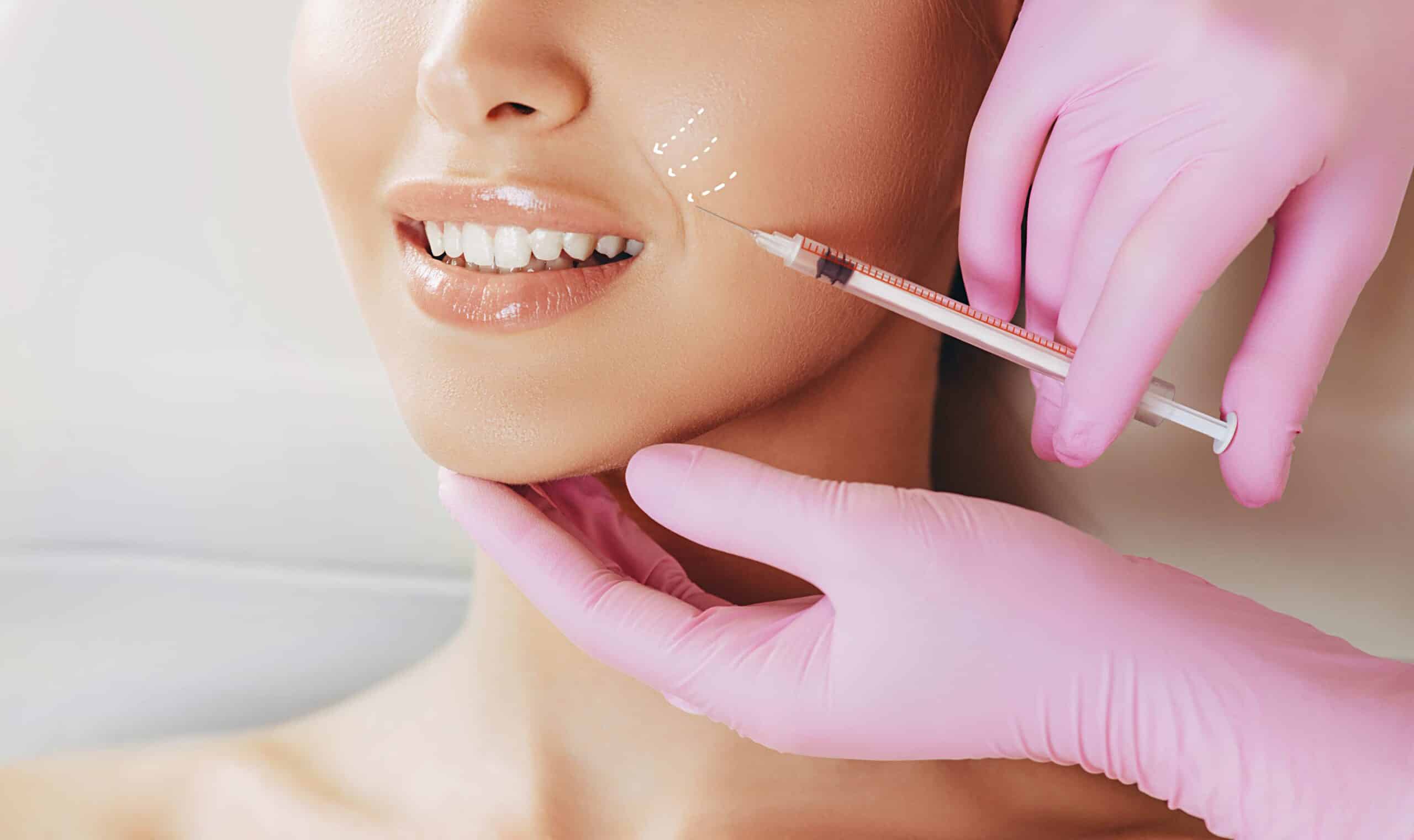 Rediscover Youthful Skin with RADIESSE® The Ultimate Dermal Filler for Natural Beauty