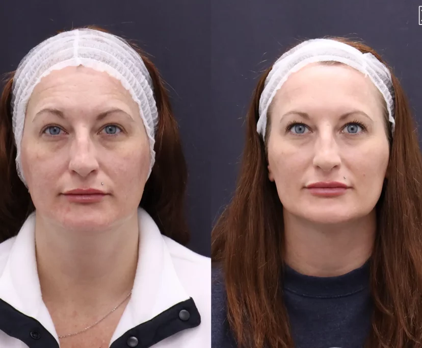 a comparison of a woman with a hair net